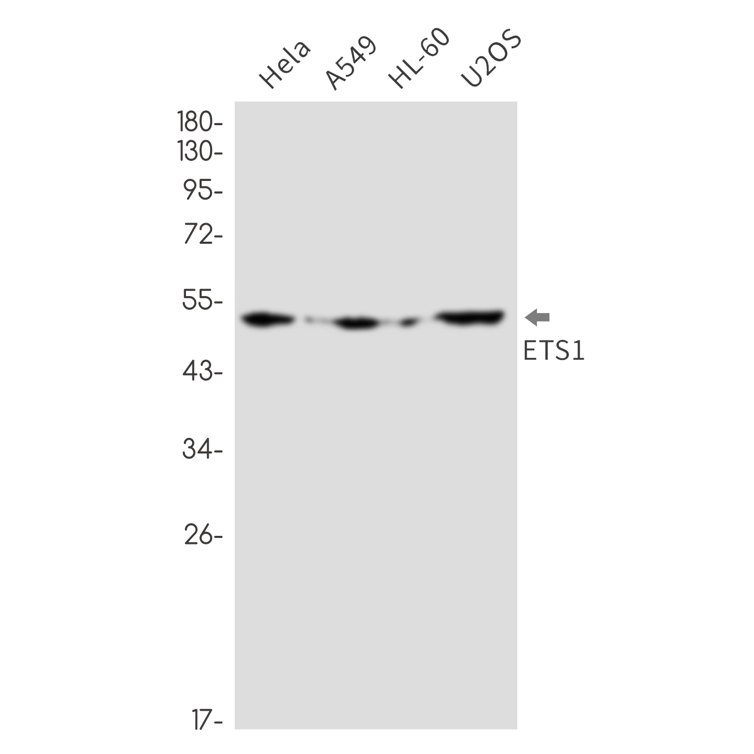 ETS1 Rabbit mAb