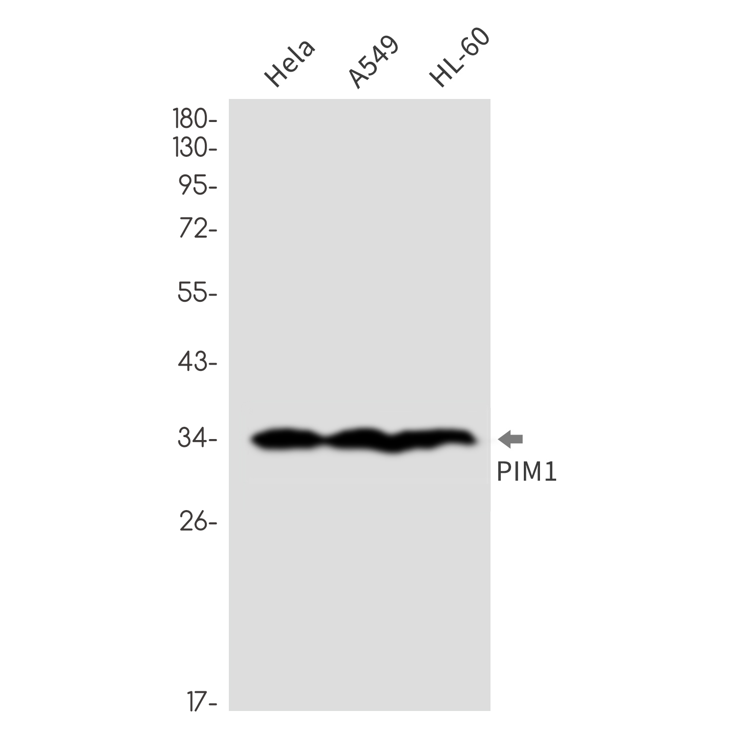 PIM1 Rabbit mAb