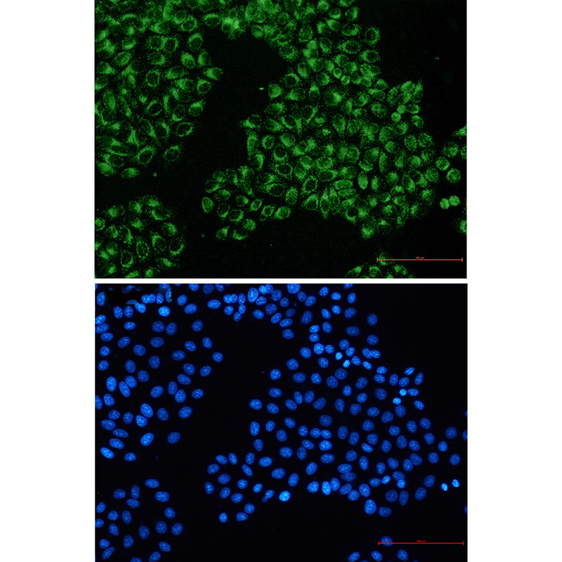 FGFR3 Rabbit mAb