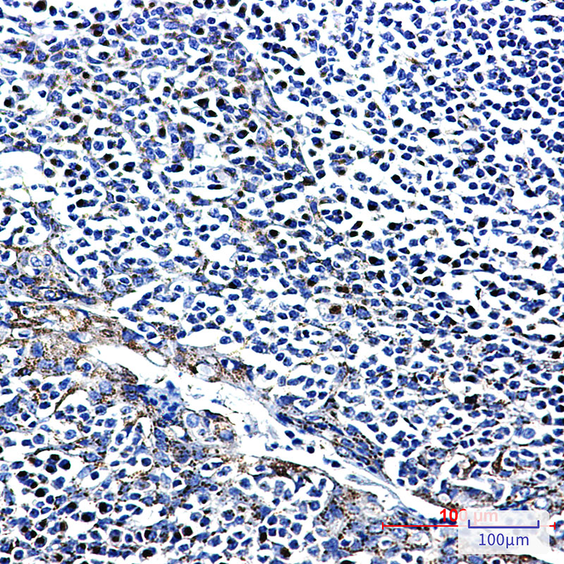 FGFR3 Rabbit mAb