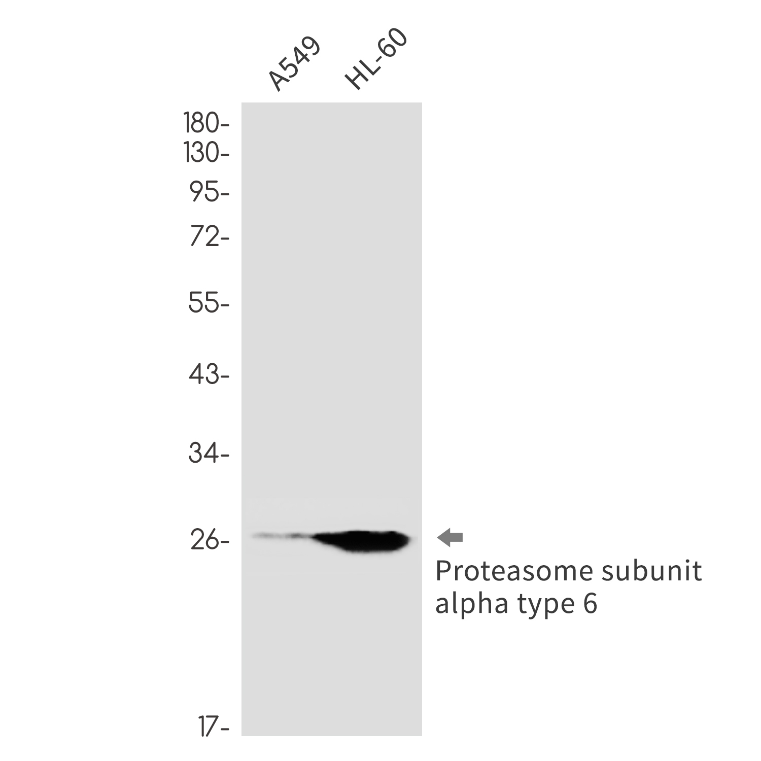 Proteasome alpha 6 Rabbit mAb