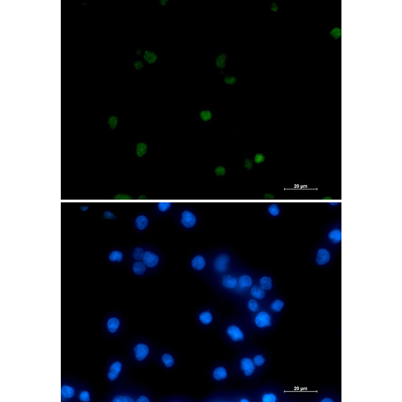 RNA Polymerase II Subunit B1 Rabbit mAb