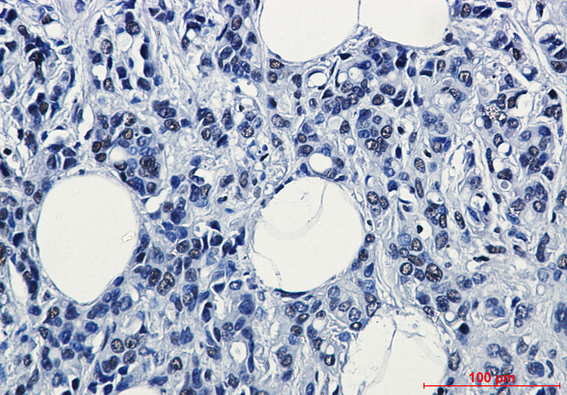 RNA Polymerase II Subunit B1 Rabbit mAb