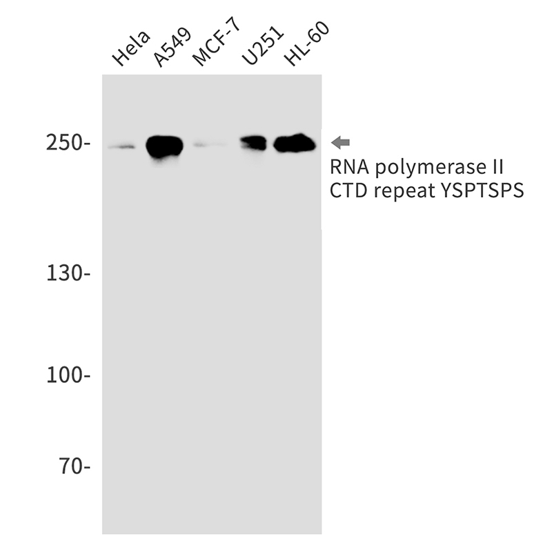 RNA Polymerase II Subunit B1 Rabbit mAb