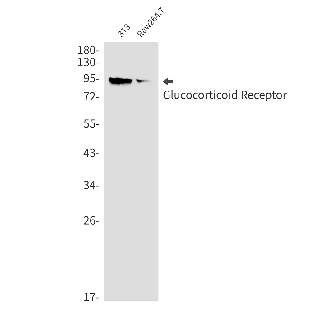 Glucocorticoid Receptor Rabbit mAb