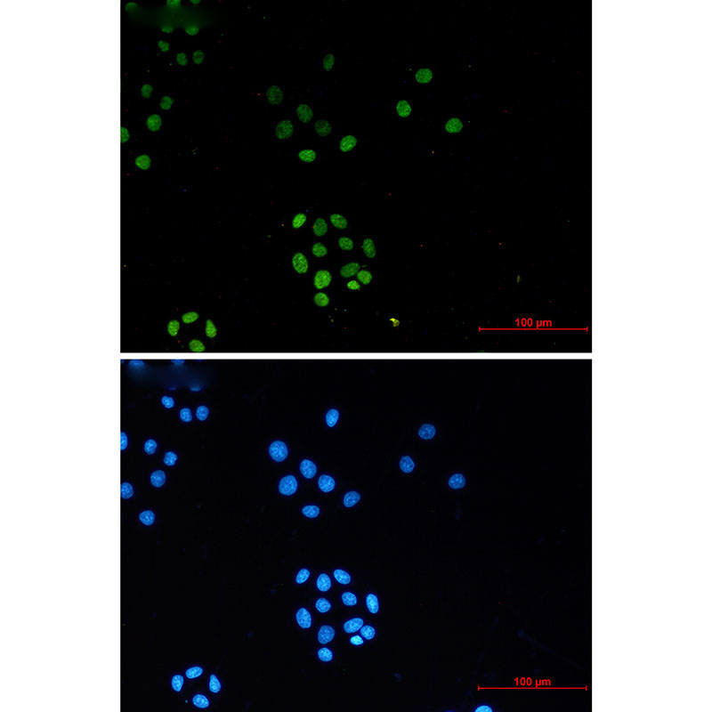 TriMethyl-Histone H3 (Lys27) Rabbit mAb