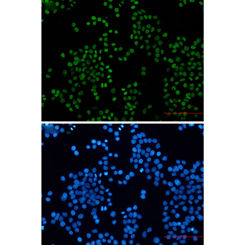 Acetyl-Histone H3 (Lys27) Rabbit mAb