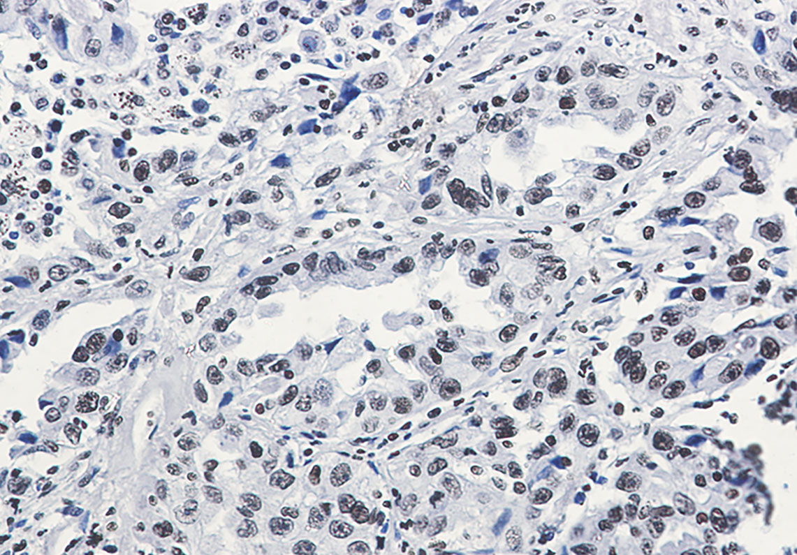 Acetyl-Histone H3 (Lys27) Rabbit mAb