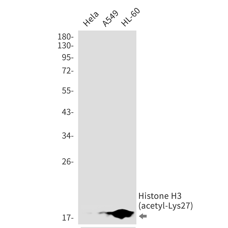 Acetyl-Histone H3 (Lys27) Rabbit mAb