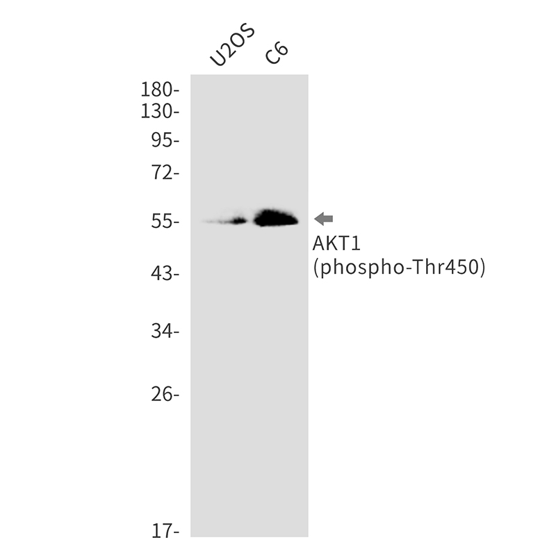 Phospho-AKT1 (Thr450) Rabbit mAb