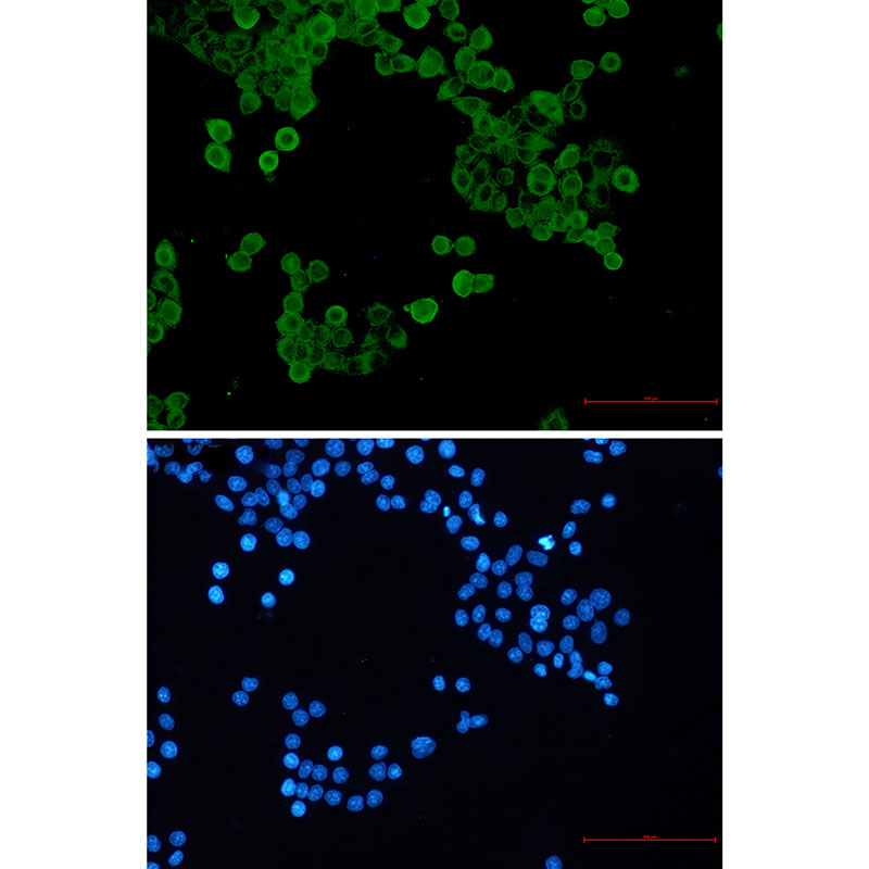 Phospho-AMPK alpha 1 (Ser496) Rabbit mAb