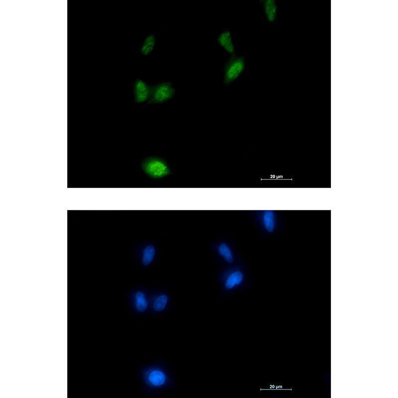 Phospho-Amyloid Precursor Protein (Thr743)  Rabbit mAb