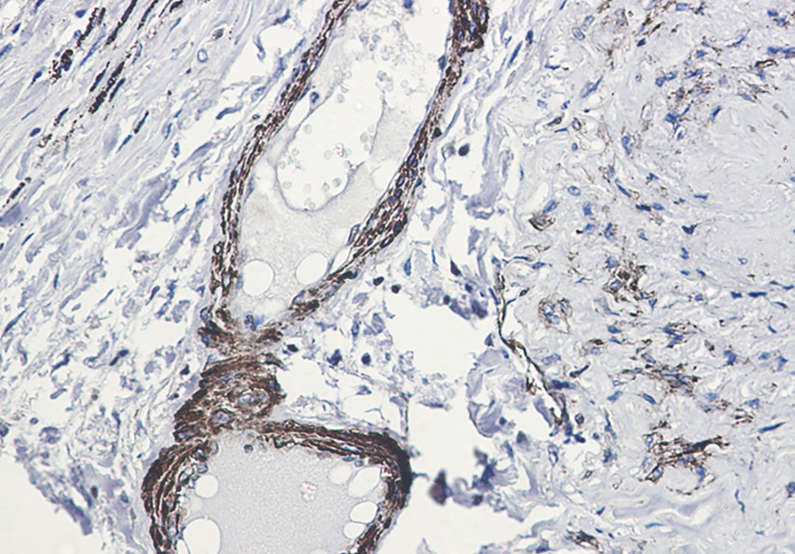 Phospho-beta Arrestin 1 (Ser412) Rabbit mAb