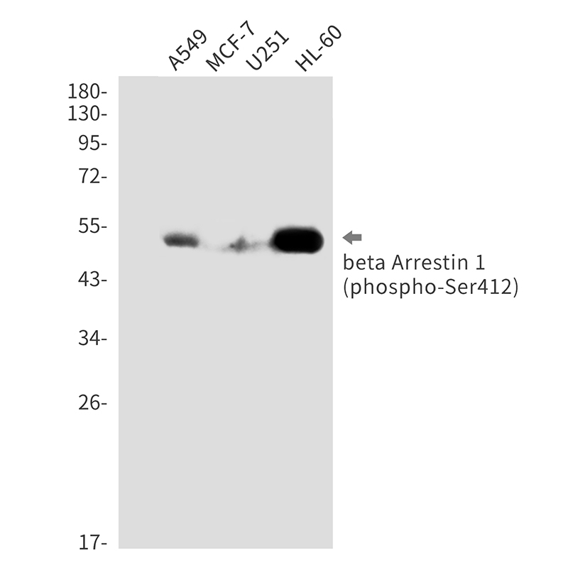 Phospho-beta Arrestin 1 (Ser412) Rabbit mAb