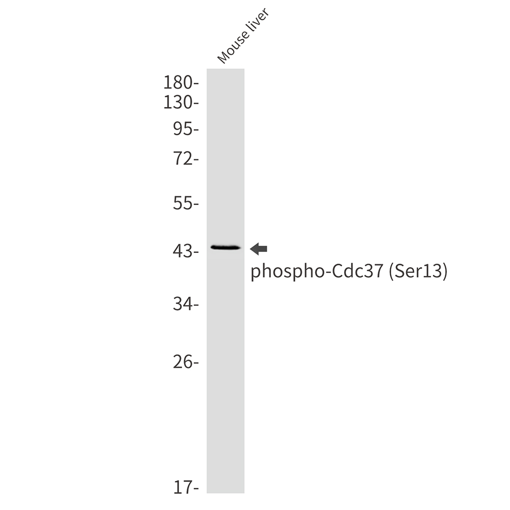 Phospho-CDC37 (Ser13) Rabbit mAb