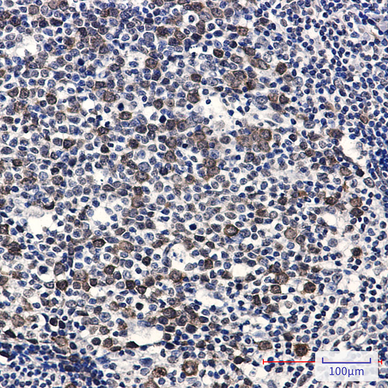 Phospho-CDK2 (Thr14) Rabbit mAb