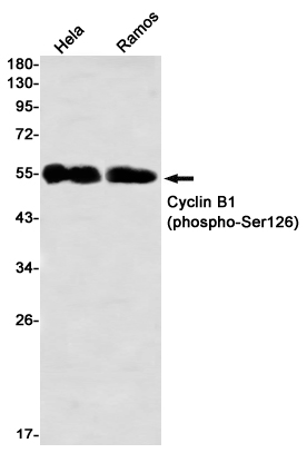 Phospho-Cyclin B1 (Ser126) Rabbit mAb