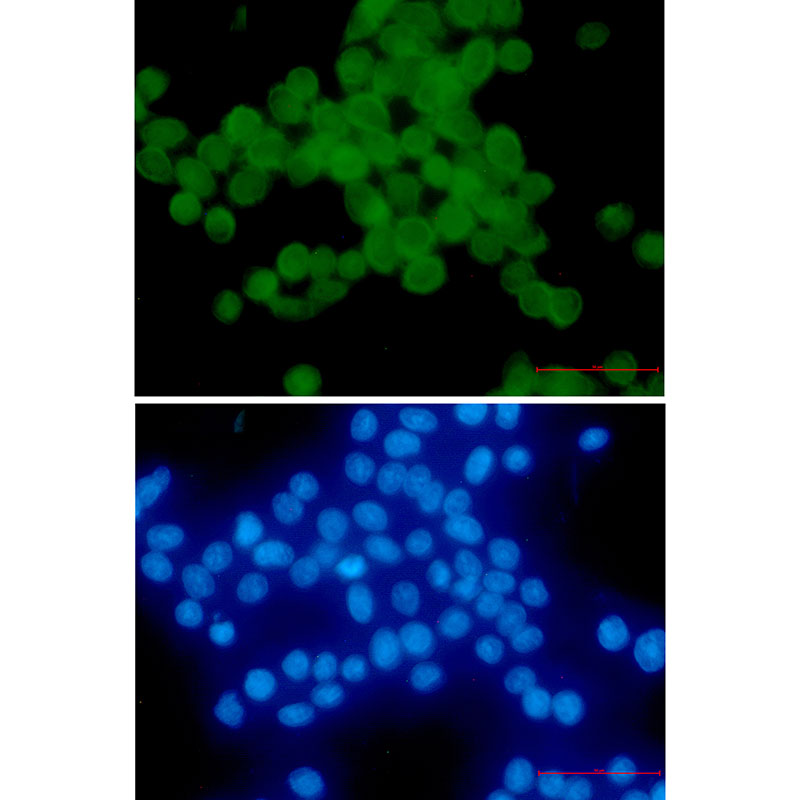 Phospho-delta 1 Catenin (Thr916) Rabbit mAb