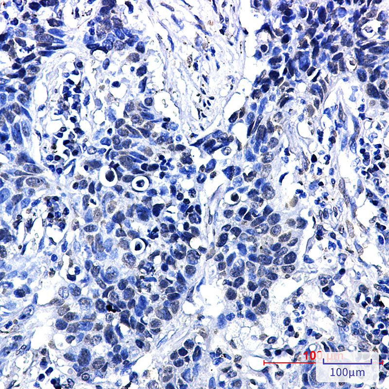 Phospho-delta 1 Catenin (Thr916) Rabbit mAb