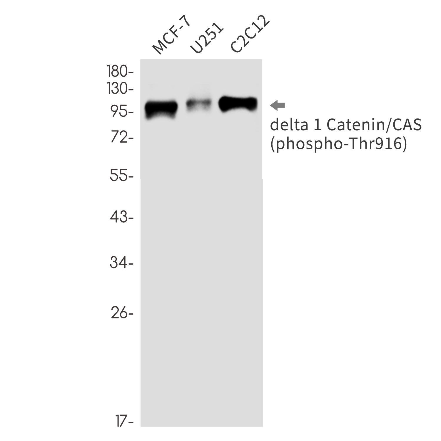 Phospho-delta 1 Catenin (Thr916) Rabbit mAb