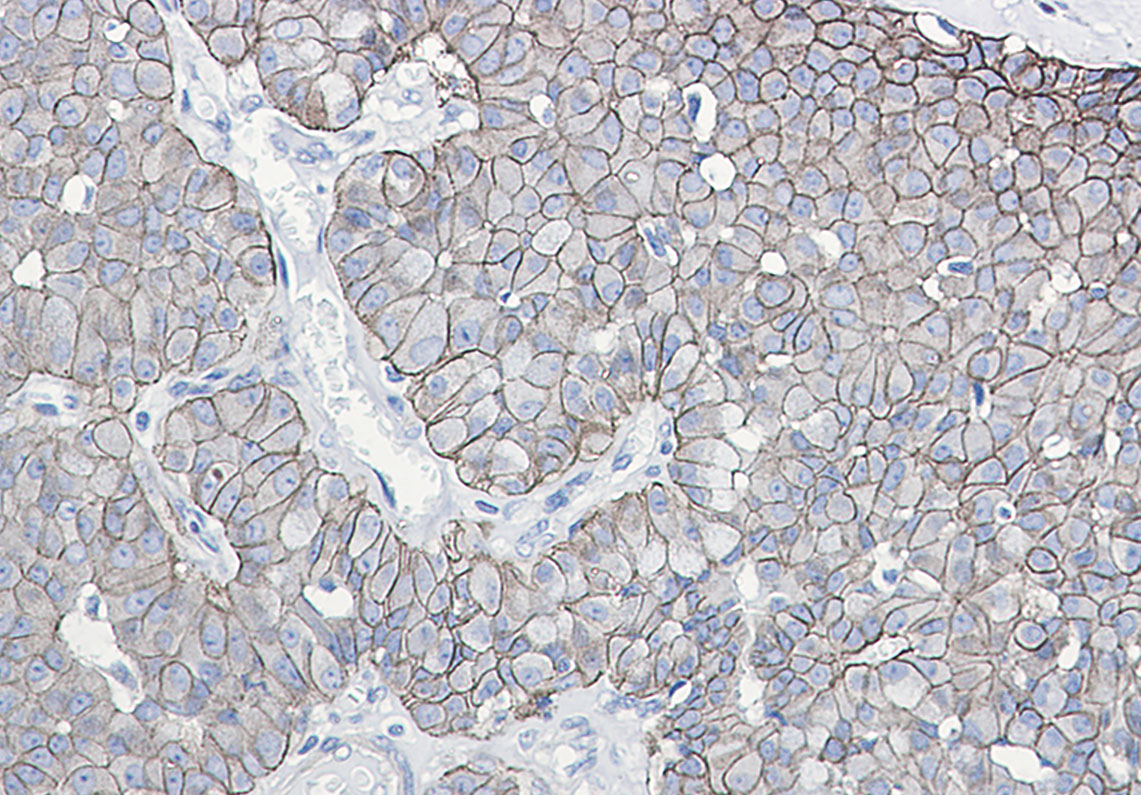 Phospho-E Cadherin (Ser838/Ser840) Rabbit mAb