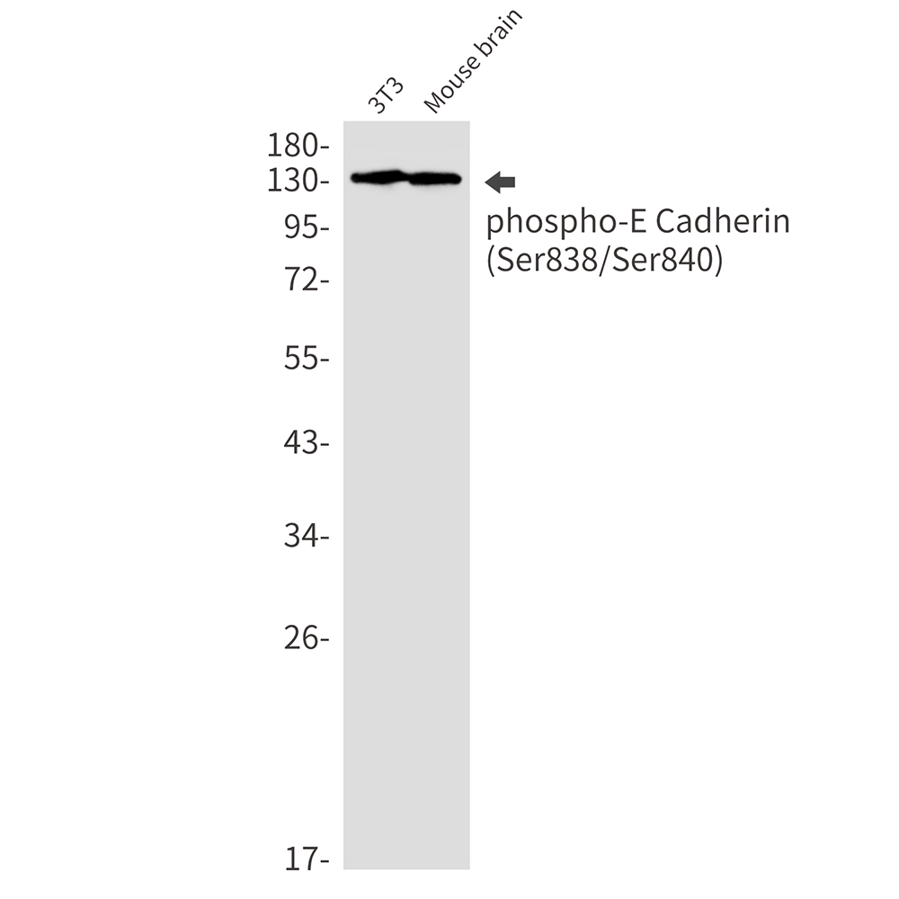 Phospho-E Cadherin (Ser838/Ser840) Rabbit mAb