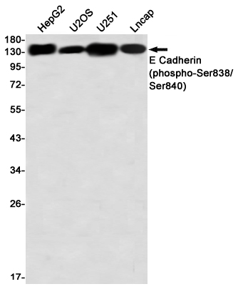 Phospho-E Cadherin (Ser838/Ser840) Rabbit mAb