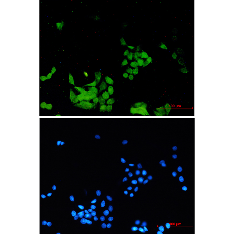 Phospho-EGFR (Tyr1173) Rabbit mAb