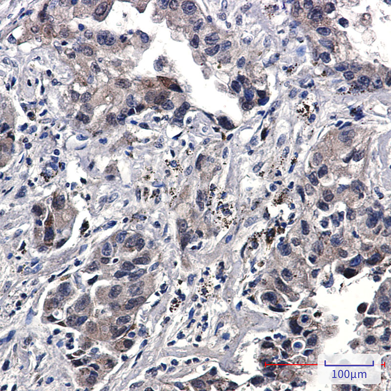 Phospho-EGFR (Tyr1173) Rabbit mAb