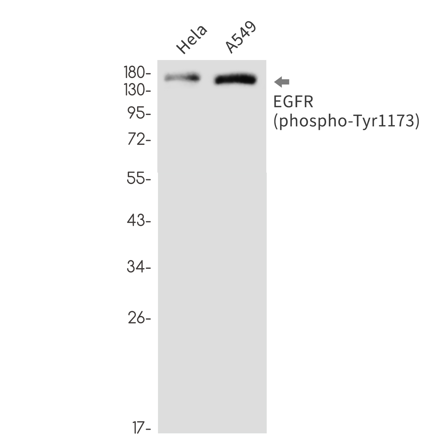 Phospho-EGFR (Tyr1173) Rabbit mAb