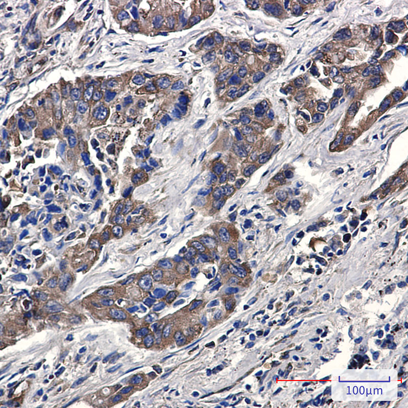 Phospho-eIF4B (Ser406) Rabbit mAb