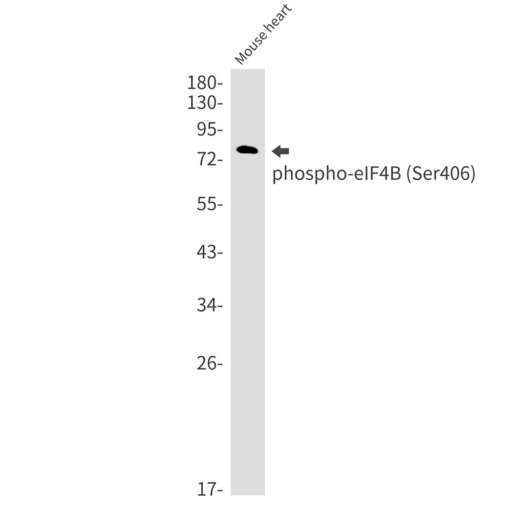 Phospho-eIF4B (Ser406) Rabbit mAb