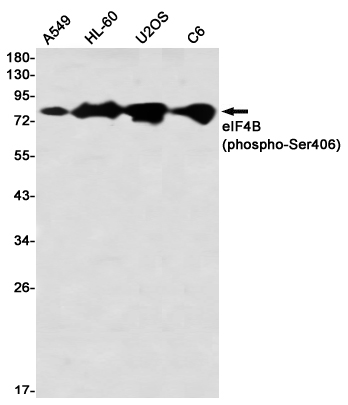 Phospho-eIF4B (Ser406) Rabbit mAb