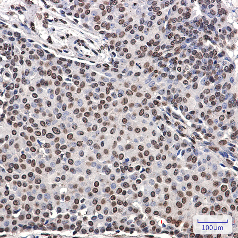 Phospho-ErbB 4 (Tyr1162) Rabbit mAb