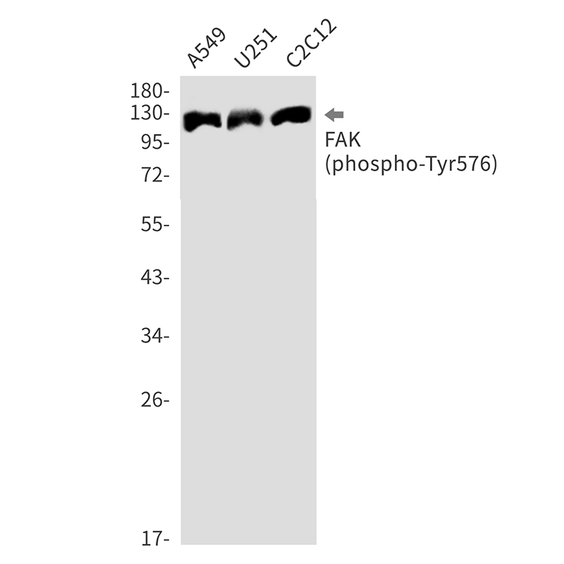 Phospho-FAK (Tyr576) Rabbit mAb