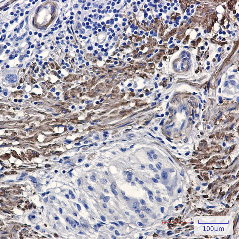 Phospho-Filamin A/B (Ser2152/Ser2107) Rabbit mAb