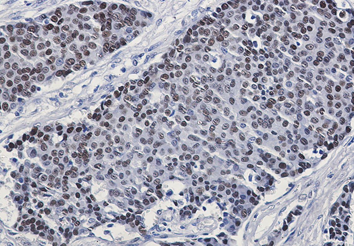 Phospho-GATA3 (Ser308) Rabbit mAb