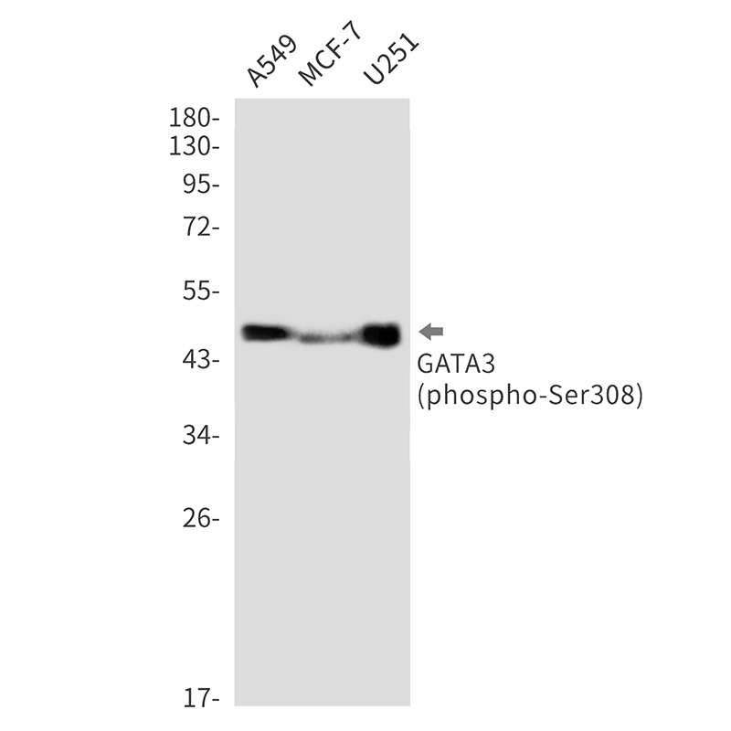 Phospho-GATA3 (Ser308) Rabbit mAb