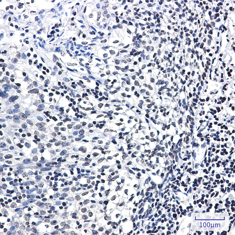 Phospho-Glucocorticoid Receptor (Ser226) Rabbit mAb