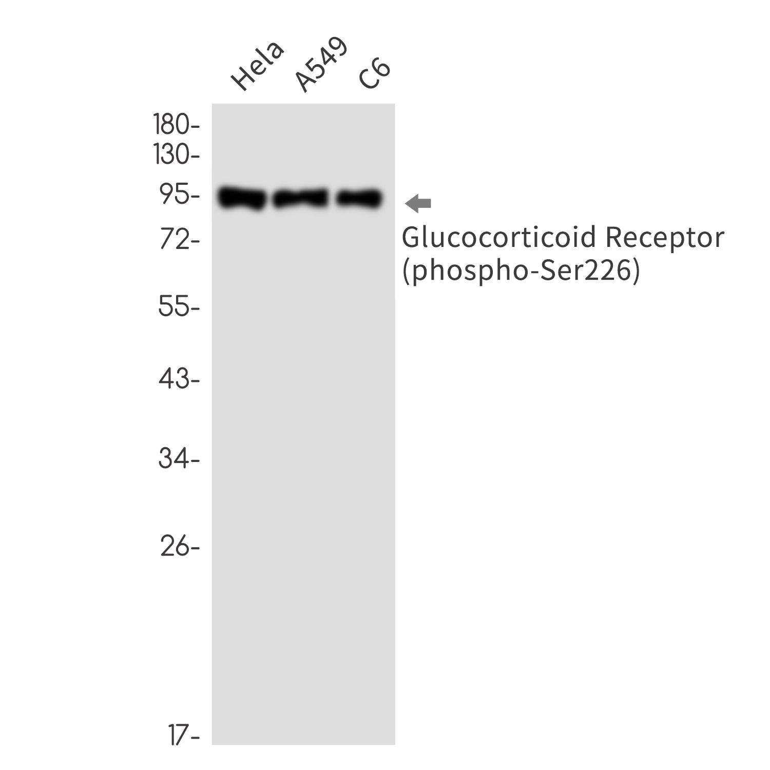 Phospho-Glucocorticoid Receptor (Ser226) Rabbit mAb