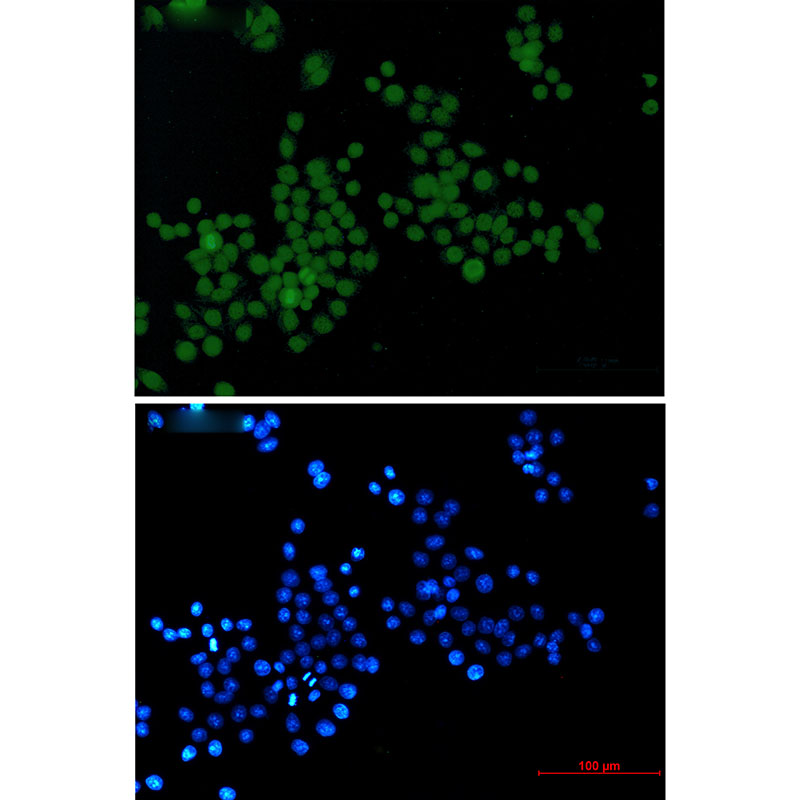 Phospho-Histone H3 (Ser10/Thr11) Rabbit mAb