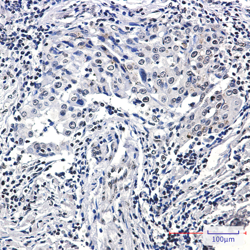 Phospho-Histone H3 (Ser10/Thr11) Rabbit mAb