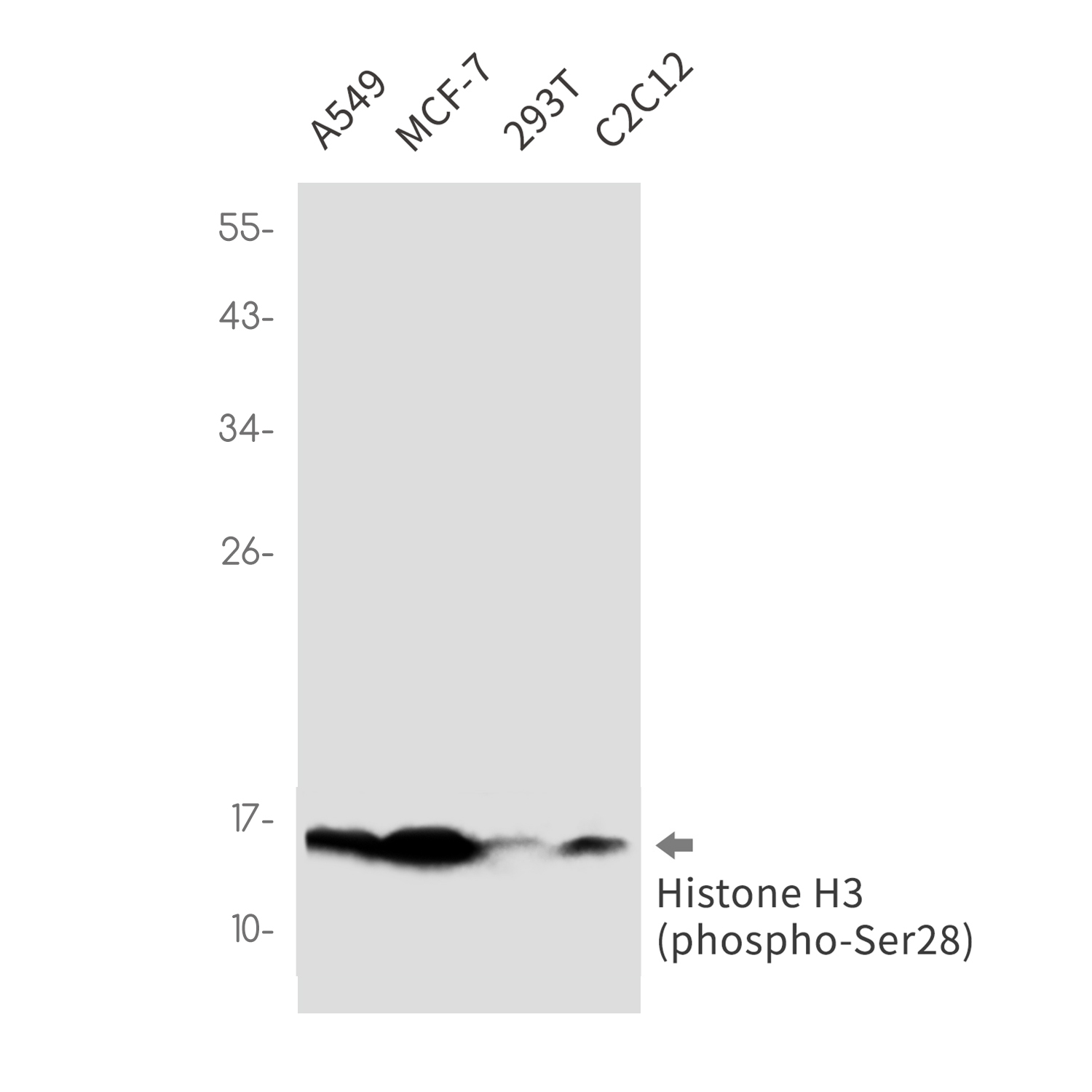 Phospho-Histone H3 (Ser28) Rabbit mAb