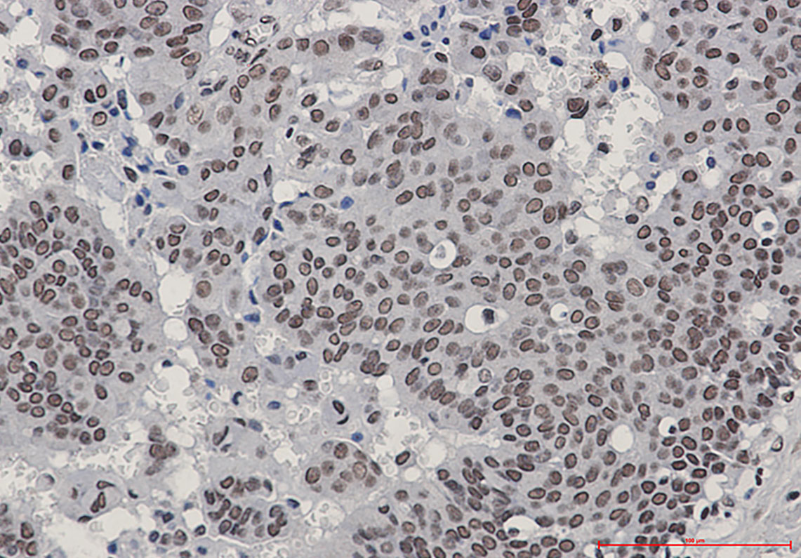 Phospho-HSF1 (Ser303/Ser307) Rabbit mAb