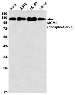 Phospho-MCM2 (Ser27) Rabbit mAb