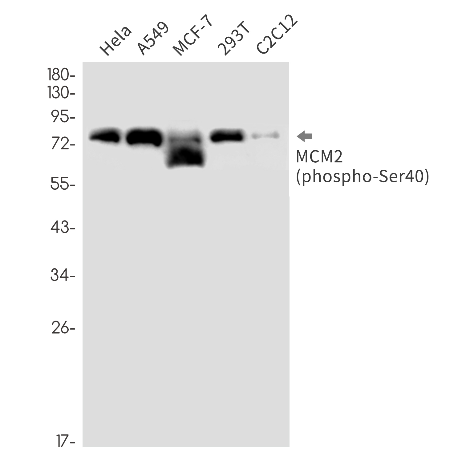 Phospho-MCM2 (Ser40) Rabbit mAb