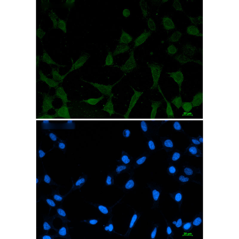 Phospho-NDRG1 (Ser330) Rabbit mAb