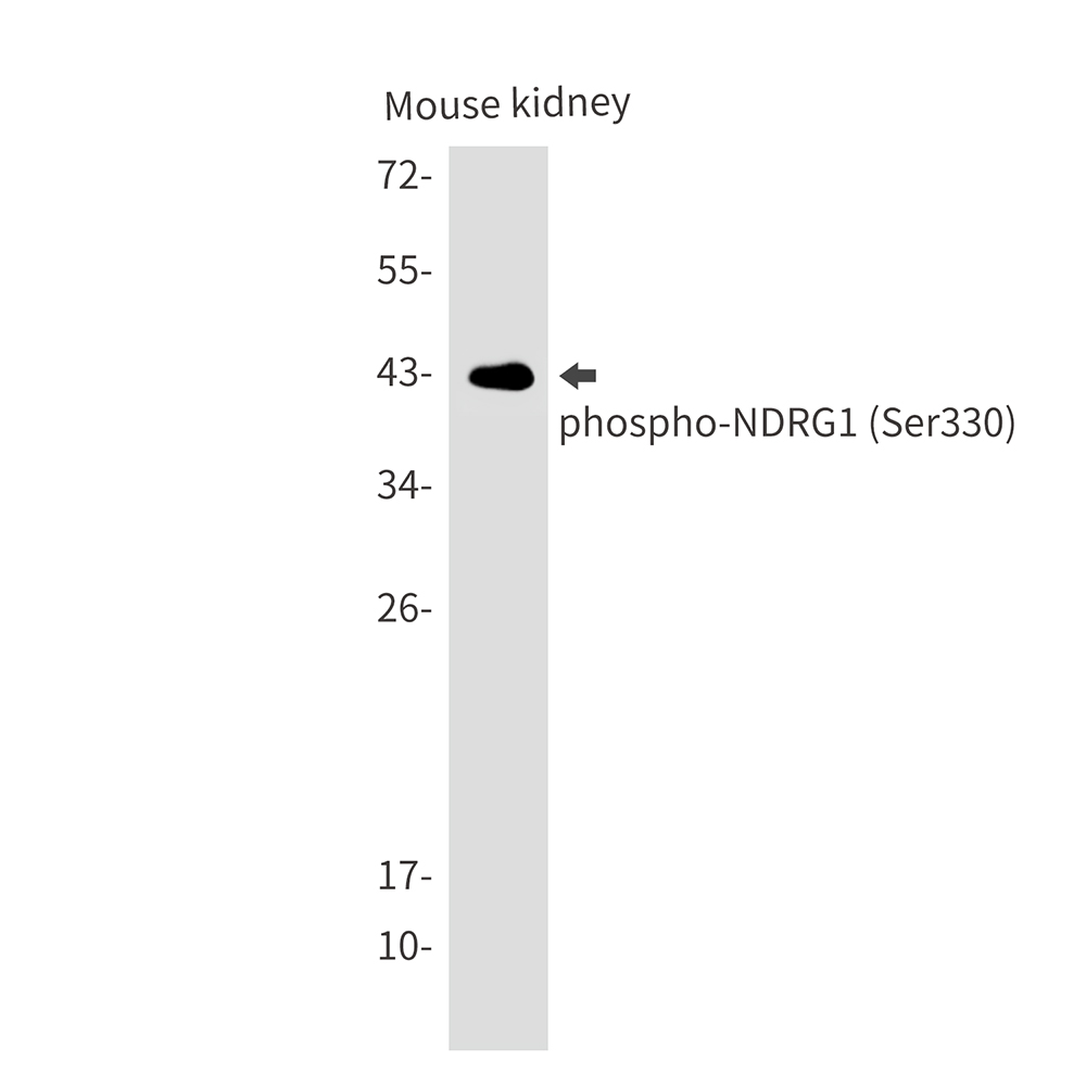 Phospho-NDRG1 (Ser330) Rabbit mAb