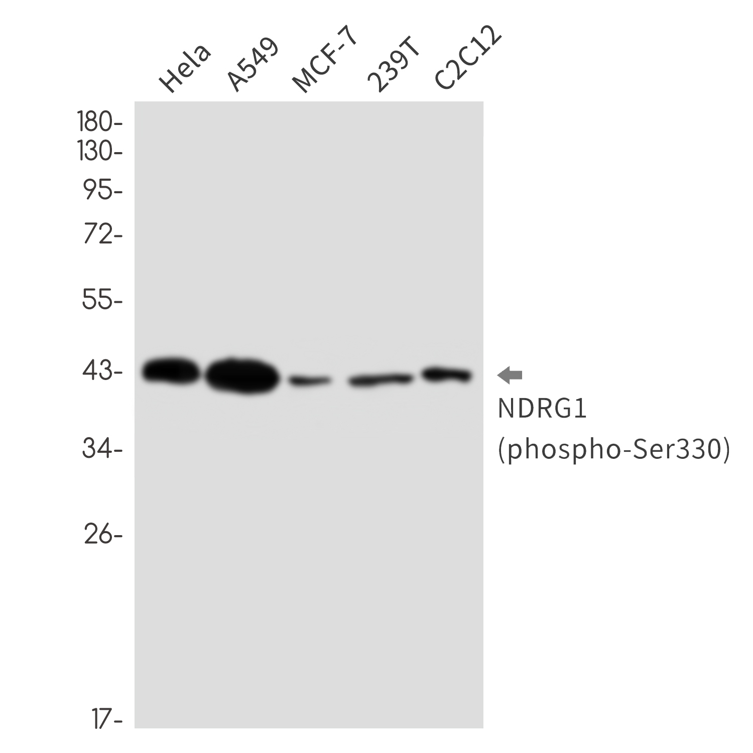 Phospho-NDRG1 (Ser330) Rabbit mAb