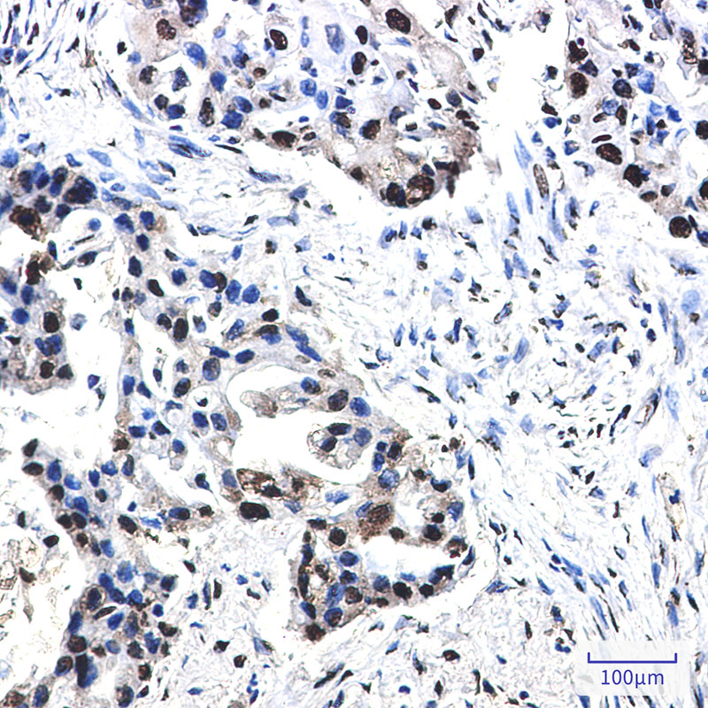 Phospho-Nucleophosmin (Thr199) Rabbit mAb